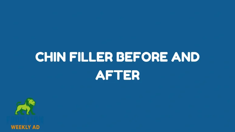 Chin Filler Before and After